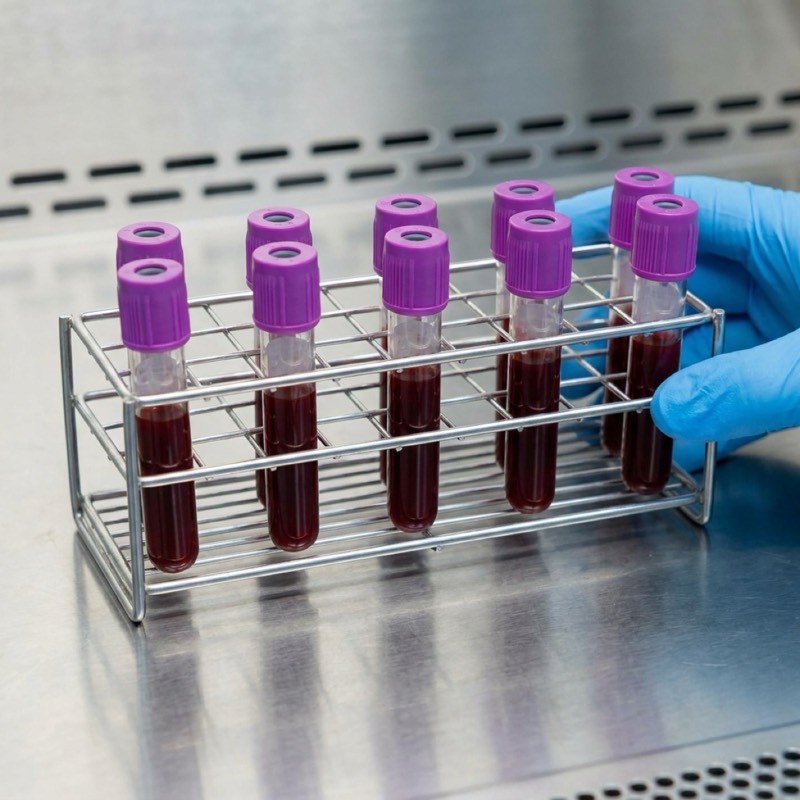 Blood sample tubes in a lab rack